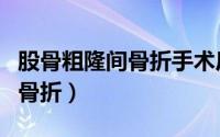 股骨粗隆间骨折手术后多久下地（股骨粗隆间骨折）