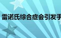 雷诺氏综合症会引发手肿吗（雷诺氏综合症）